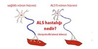 ALS2.jpg